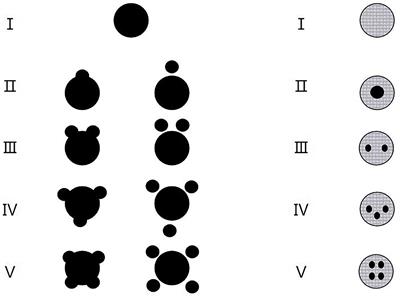 The signs of computer tomography combined with artificial intelligence can indicate the correlation between status of consciousness and primary brainstem hemorrhage of patients